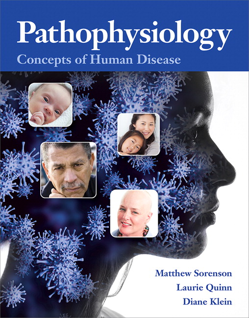 Test Bank for Pathophysiology: Concepts of Human Disease Sorenson