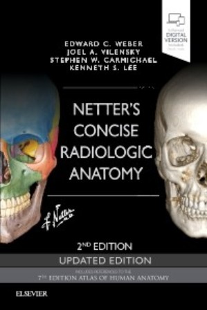 Test Bank for Netter's Concise Radiologic Anatomy Updated Edition 2nd Edition Weber