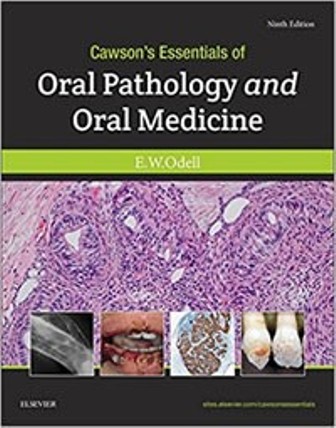 Test Bank for Cawson's Essentials of Oral Pathology and Oral Medicine 9th Edition Odell