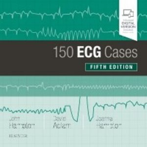 Test Bank for 150 ECG Cases 5th Edition Hampton
