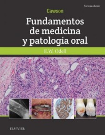 Test Bank for Fundamentos de medicina y patología oral 9th Edition Cawson