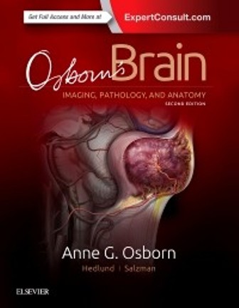 Test Bank for Osborn's Brain 2nd Edition Osborn