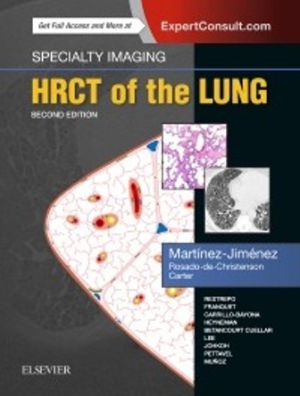Test Bank for Specialty Imaging: HRCT of the Lung 2nd Edition Martinez-Jimenez