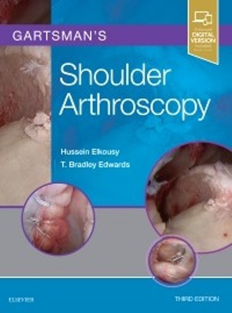 Test Bank for Gartsman's Shoulder Arthroscopy 3rd Edition Elkousy