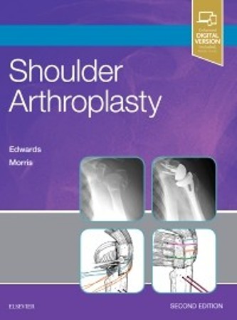 Test Bank for Shoulder Arthroplasty 2nd Edition Edwards