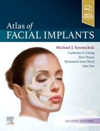 Test Bank for Atlas of Facial Implants 2nd Edition Yaremchuk
