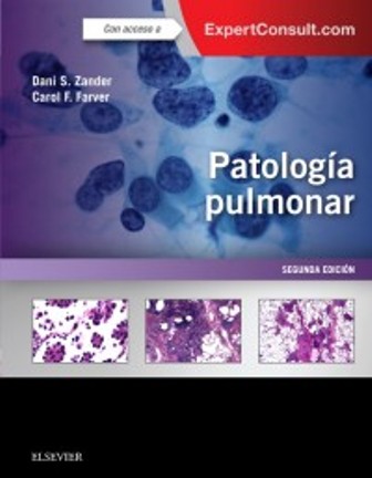 Test Bank for PATOLOGÍA PULMONAR 2nd Edition Zander