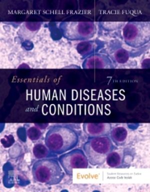 Essentials of Human Diseases and Conditions 7th Edition Frazier
